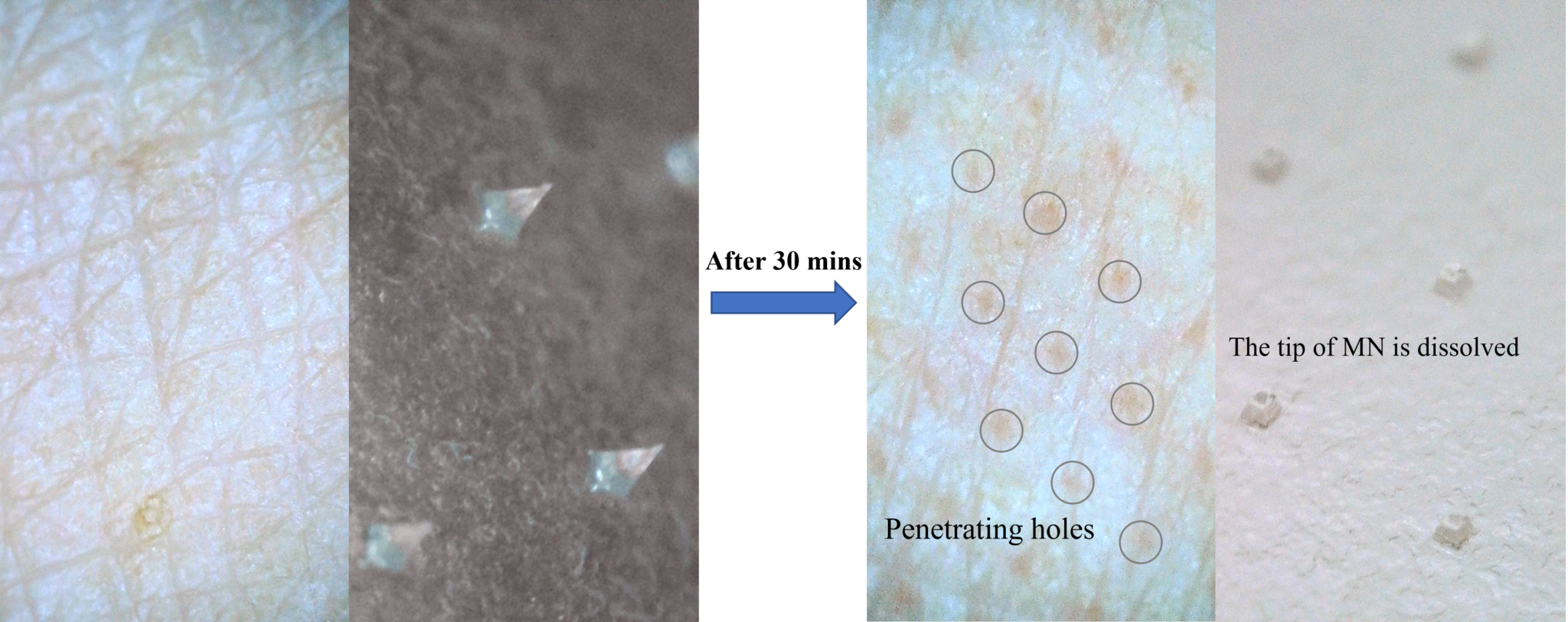 Cosmetics Microarray Patch - WCC Biomedical